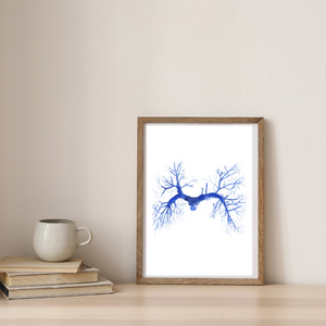 Pulmonary Embolism CT Angiography Watercolor Art Print