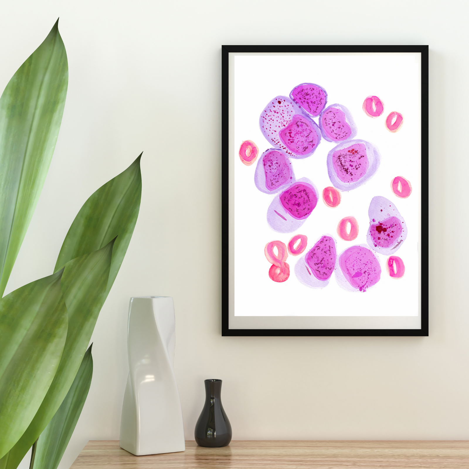 AML Bone Marrow Hisopathology Art