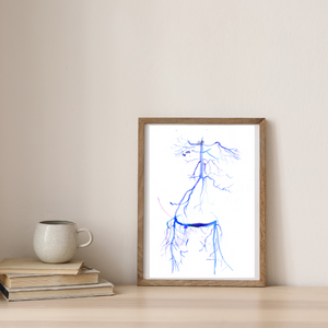 Crossover iliac artery bypass