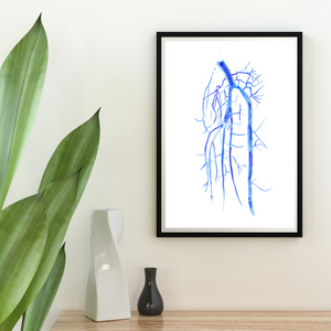 Popliteo-tibial Angiography Art Print
