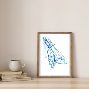 Upper Limb DSA, Vascular Surgery Radiology Art Print