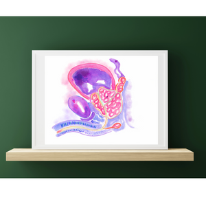 Prostatic Benign Hyperplasia Urology Artwork