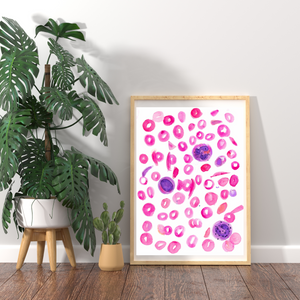 Sickle Cell Anemia Art Print