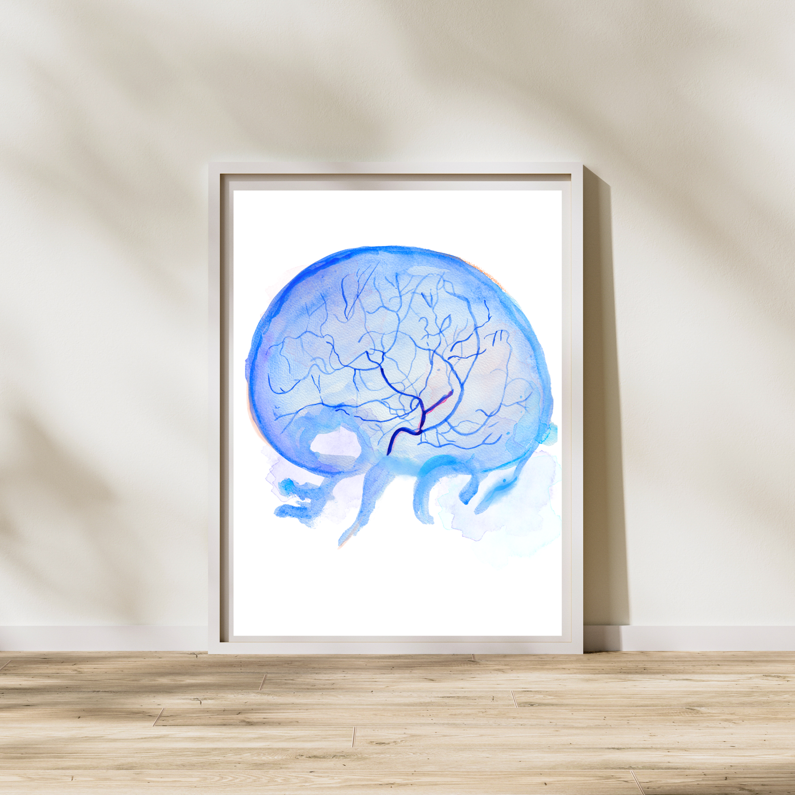 Cerebral Angiography Art Print