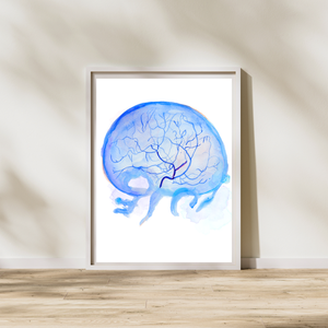 Cerebral Angiography Art Print
