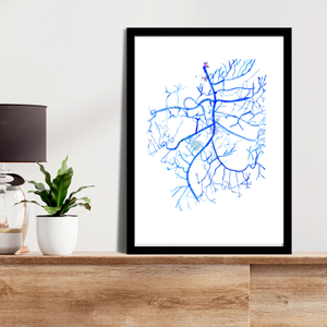 Mesenteric Arteries Angiography