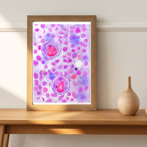 Hodgkin Lymphoma Watercolor Art Print