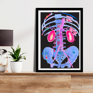 Abdominal CTA Aorta, Kidney Vascular Abstract Anatomy Art Print