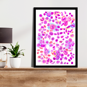 Acute Lymphoblastic Leukemia Hematooncology Art Print