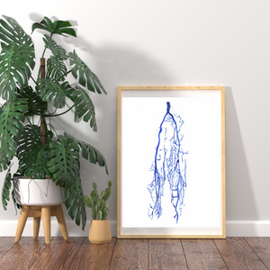 Lover Limb Varicose Vein Venography Art