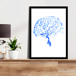 Cerebral Angiography Watercolor Art Print