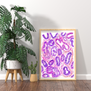 Ovarian Cancer Histopathology Art