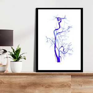 Carotis Angiography,  Radiology Art Print, Neurology Neurosurgery Art, Vascular Surgery Print, Rad Tech Gift, Vascular Anatomy, Radiology