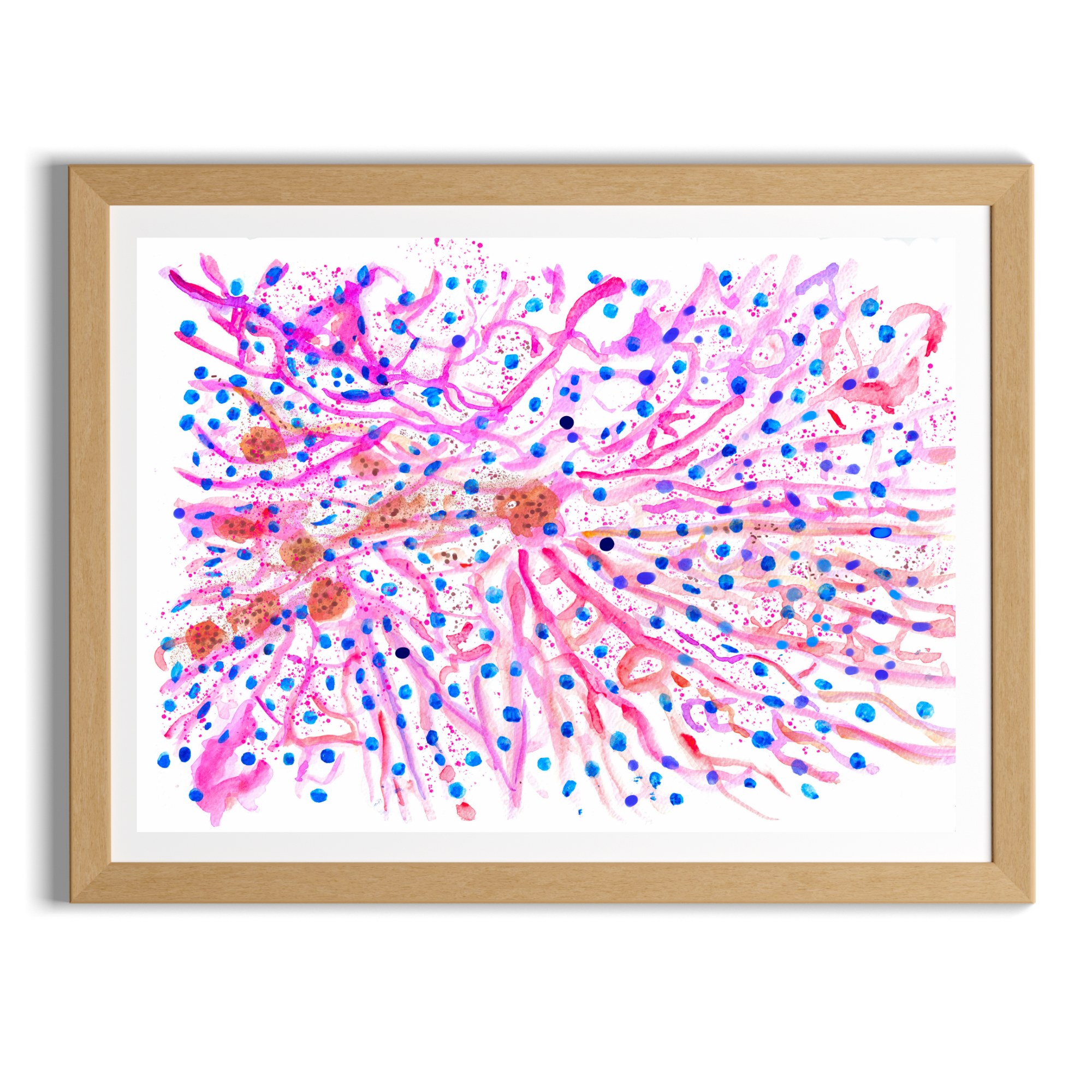 hematochromatosis art print
