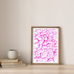 Renal Clear Cell Carcinoma Histopathology Art Print