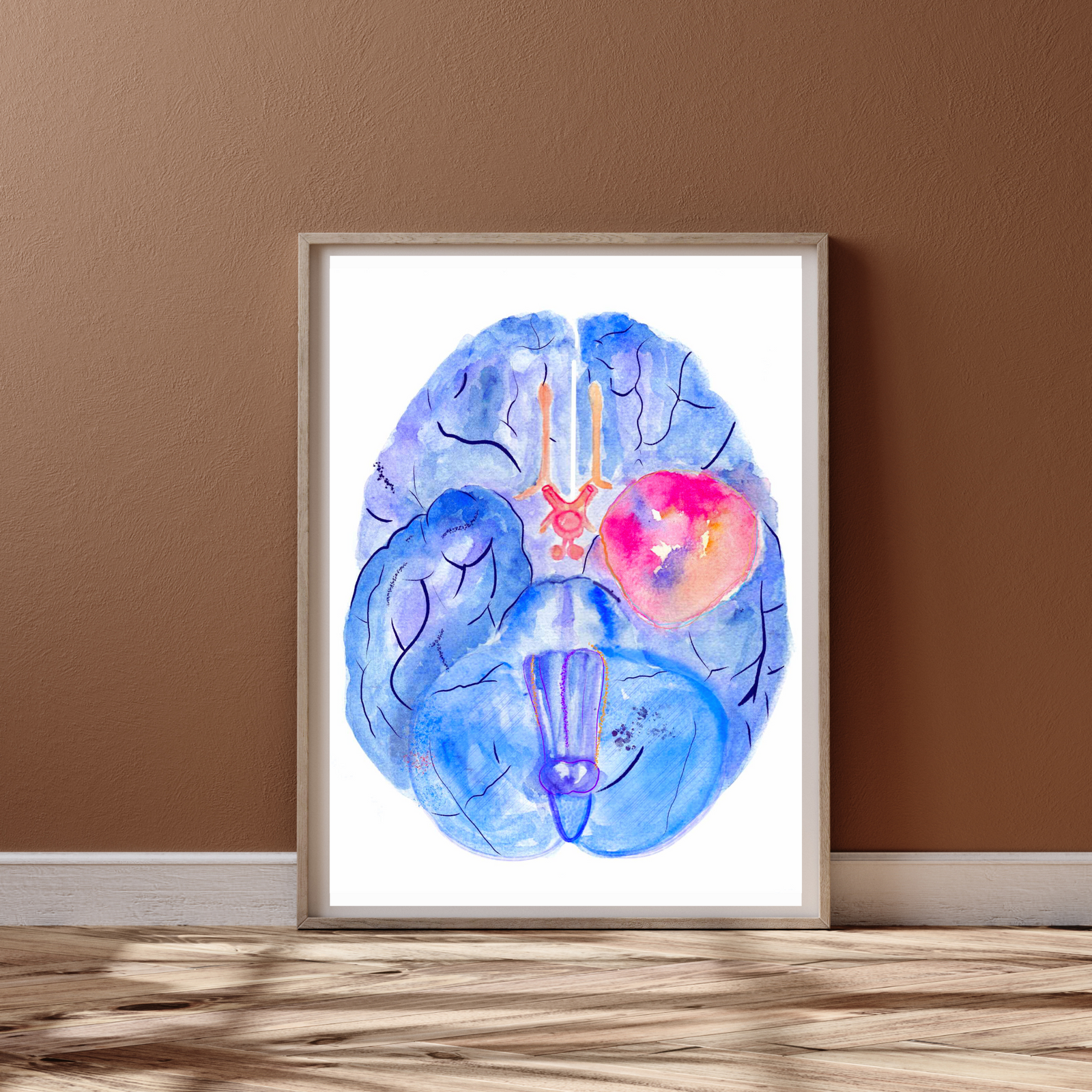 Meningioma Brain Anatomy Watercolor Art Print