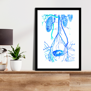 Pelvic Congestion Syndrome Venography Watercolor Art Print