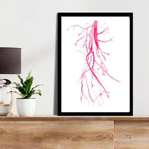 Angiography Femoral Spf Artery Occlusion Anatomy Art Print