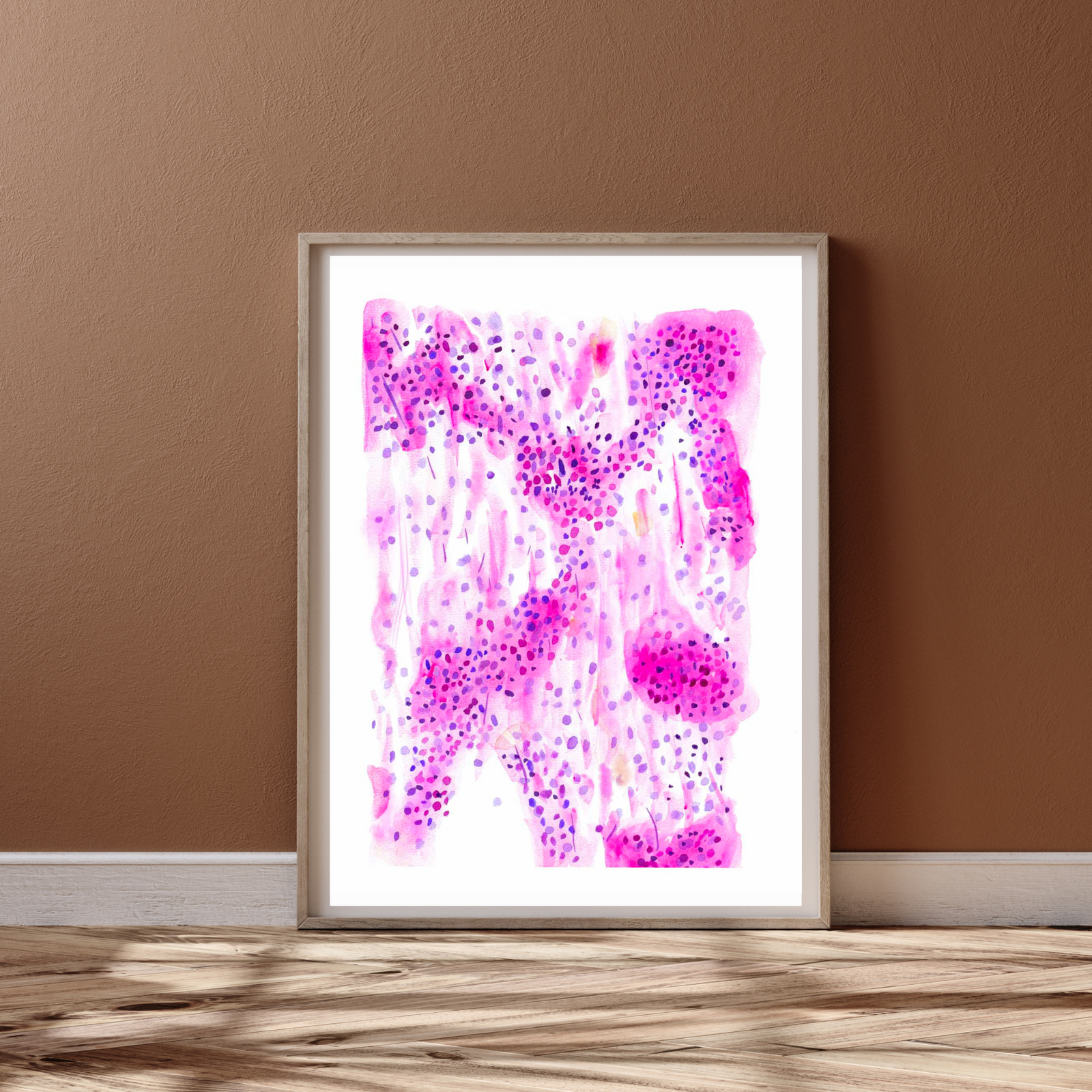 Meningioma Smear Cytopathology Art