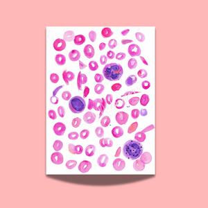 Sickle Cell Anemia Art Print