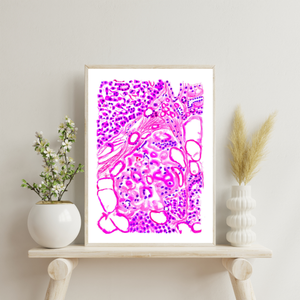 Diabetes Art, Pathology Art, Histopathology Art, Pathology Assistant, Diabetes type 2, Pathologist Gifts, Diabetes Poster, Pancreas