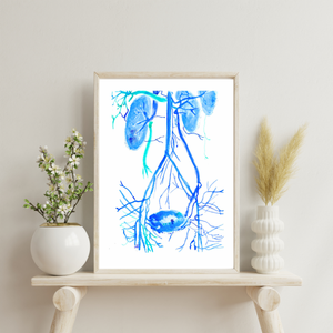 Pelvic Congestion Syndrome Venography Watercolor Art Print