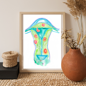 Uterine Fibroids Art Print for OBGYN Offices