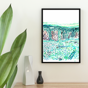 Melanoma Abstract Anatomy Art Print