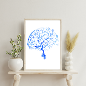 Cerebral Angiography Watercolor Art Print