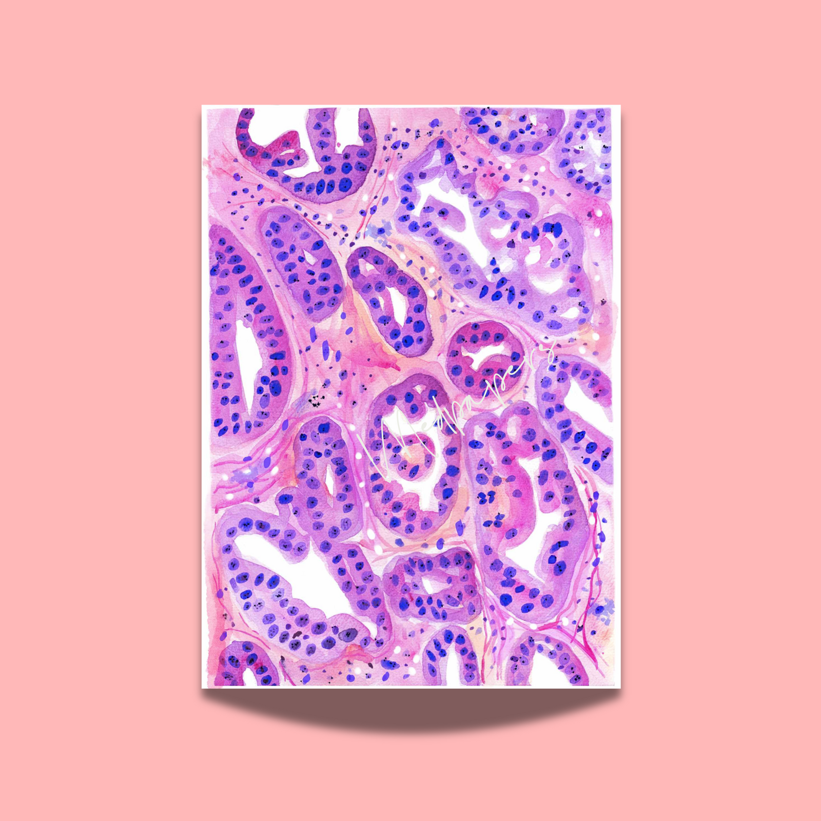 Ovarian Cancer Histopathology Art