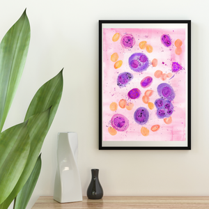 Multiple Myeloma Histopathology Art