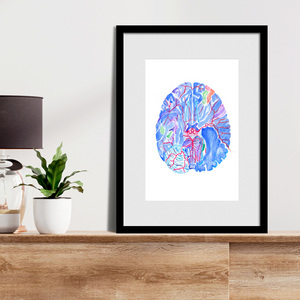 Circle of Willis Brain Anatomy Art Print