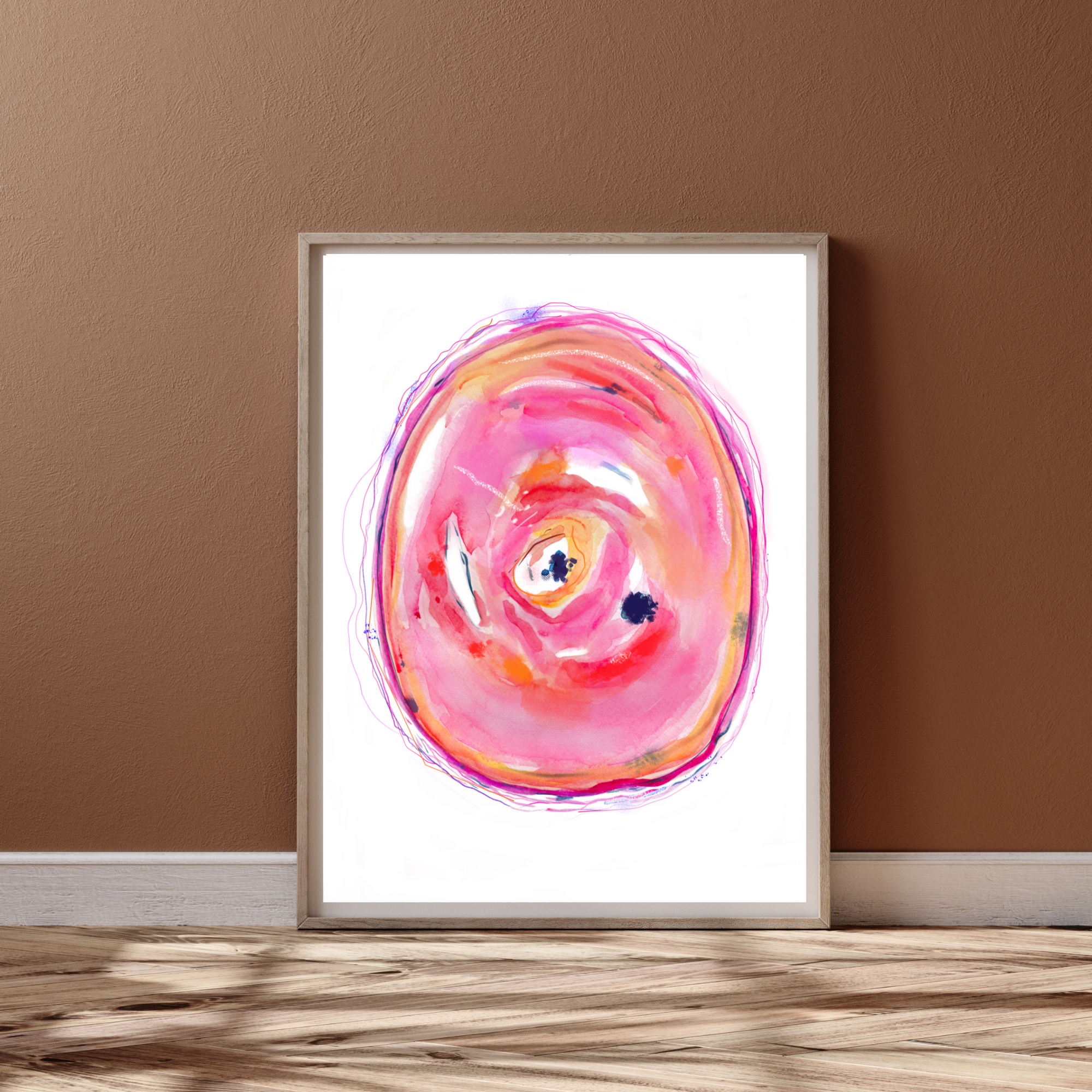 atherosclerotic  artery histology art print