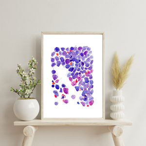 Acute Myeloid Leukemia Art Print