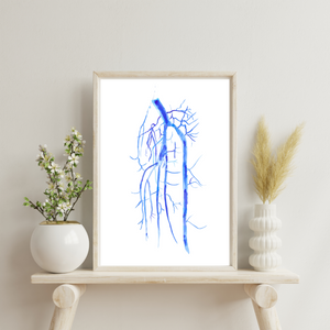 Popliteo-tibial Angiography Art Print