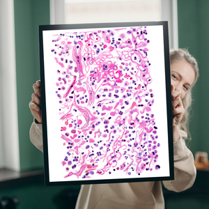 Pneumonia Histopathology Artwork