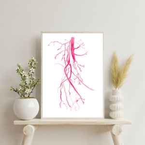 Angiography Femoral Spf Artery Occlusion Anatomy Art Print