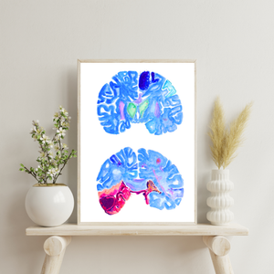 Stroke Art, Pathology Wall Decor, Neurology Print