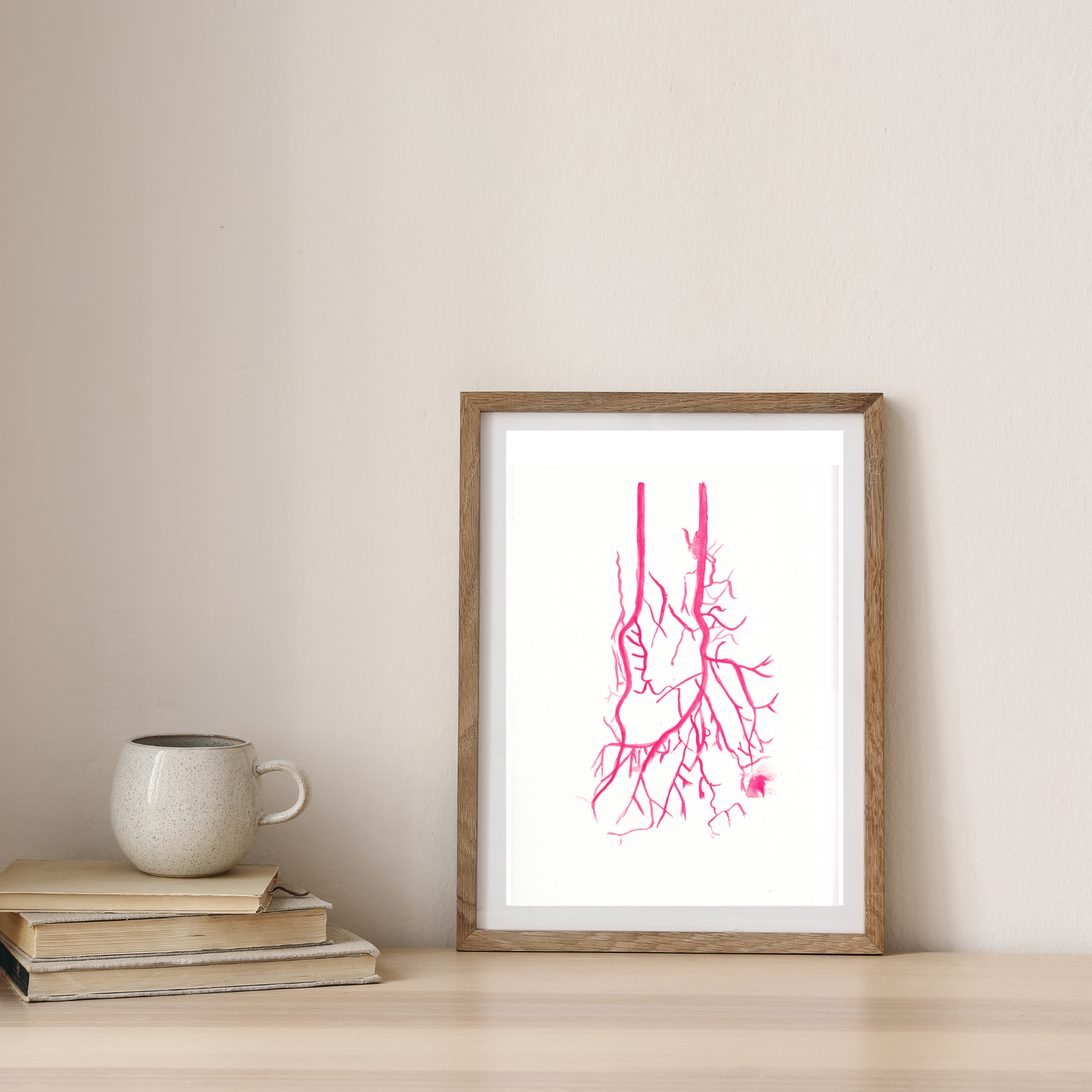 Tibio-Pedal Artery Art Print