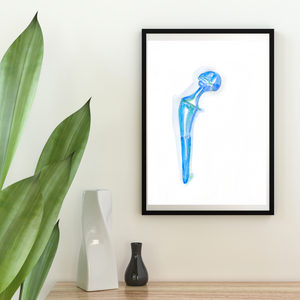 Hip Implant Watercolor Art Print