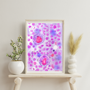 Hodgkin Lymphoma Watercolor Art Print