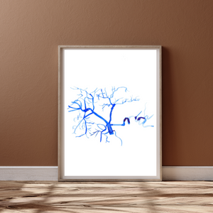 Celiac Trunk Arteriogram Interventional Radiology Vascular Gastroenterology Surgery Art Print