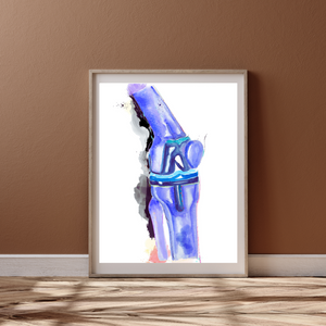 Knee Replacement Orthopedic Surgery Art Print