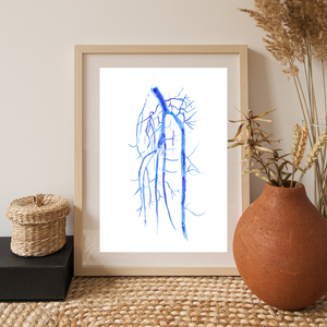 Popliteo-tibial Angiography Art Print