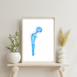 Hip Implant Watercolor Art Print