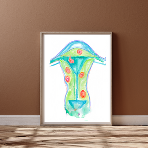 Uterine Fibroids Art Print for OBGYN Offices