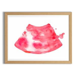 Ultrasound-Guided Popliteal Sciatic Nerve Block Anesthesiology Art