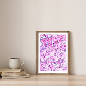 Renal Transplant Tubulitis Acute TcMR Pathology Watercolor Art Print