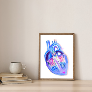 Transaortic Valve Replacement Watercolor Art Print