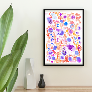 Mastocytosis Bone Marrow Smear Watercolor Art Print